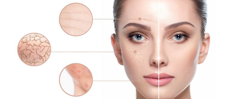 healthier skin