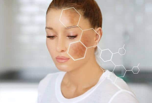 Hyperpigmentation on skin