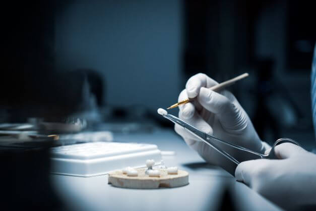 peparing dental crown
