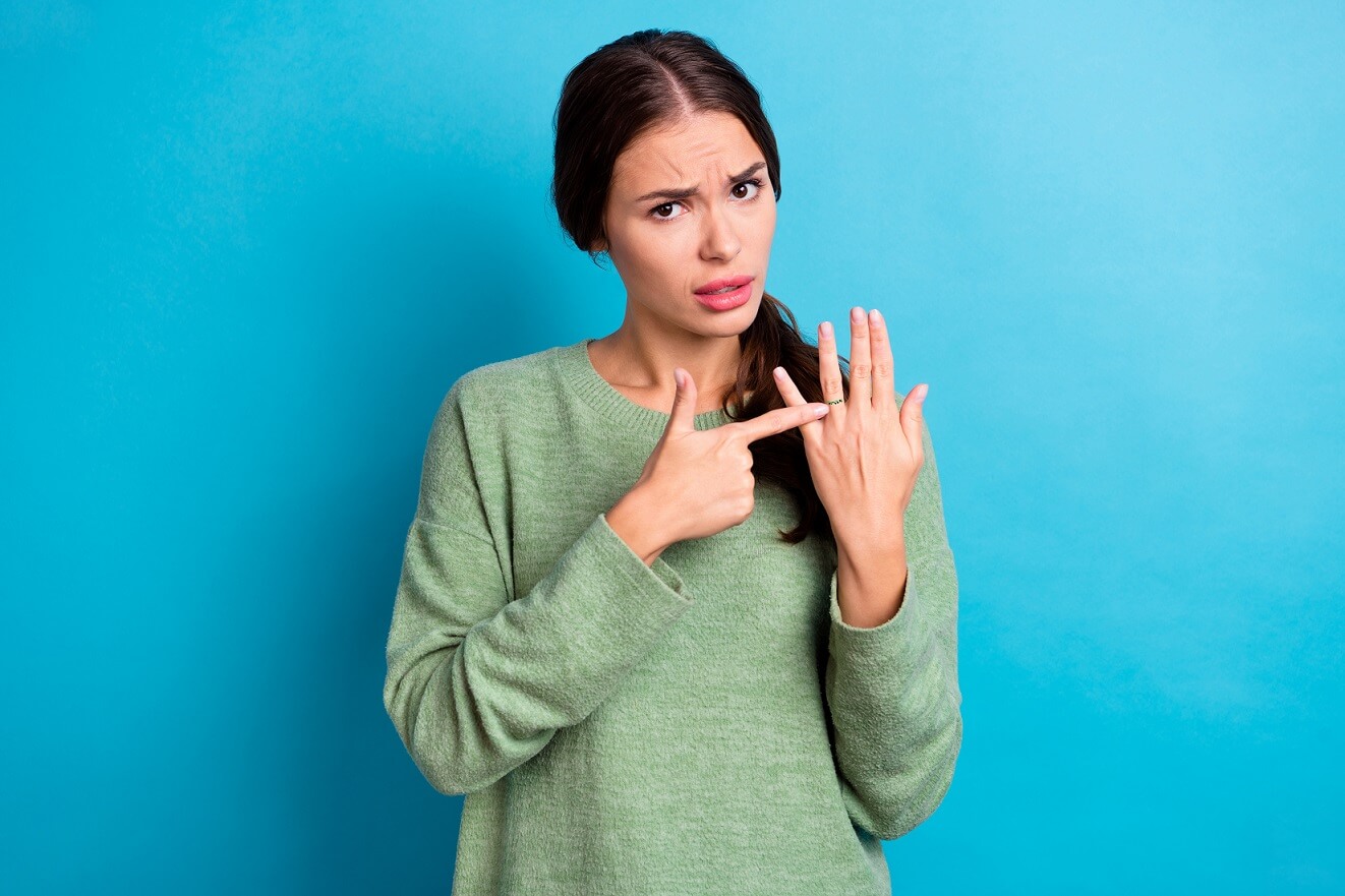 ring turning finger black or green